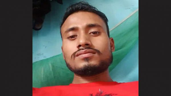 আগুনে দ্গ্ধ ব্যাক্তি