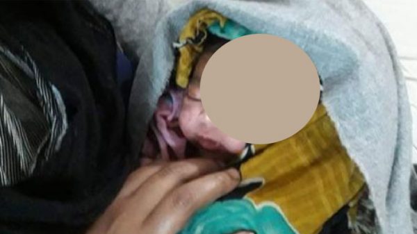 সিজারের সময় নবজাতকের কপাল কাটা সেই আয়া গ্রেফতার